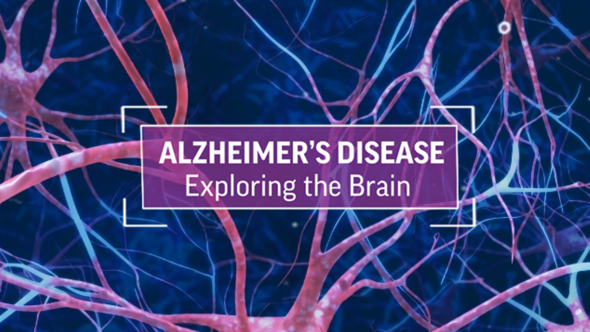 Alzheimer's Disease: Exploring The Brain